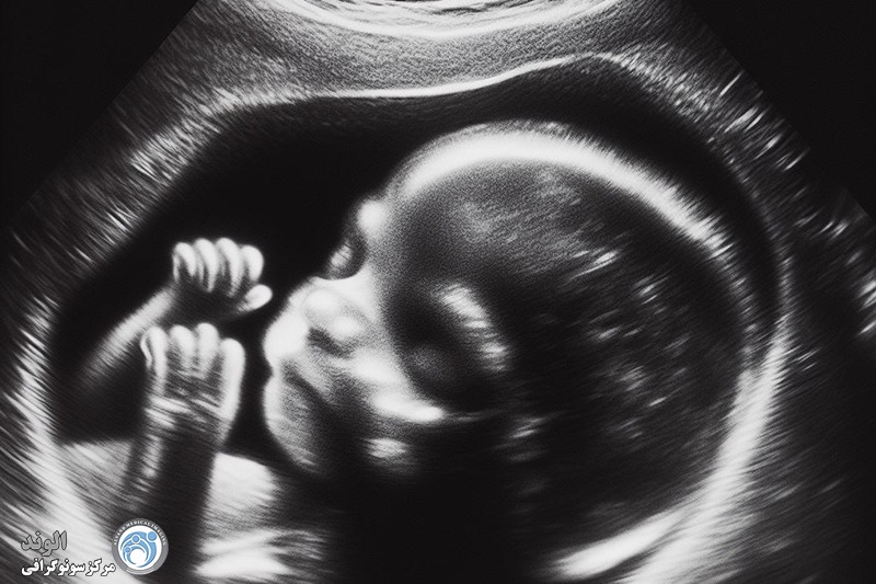 سونوگرافی بارداری|سونوگرافی حاملگی|سونوگرافی تشخیص جنسیت|سونوگرافی 