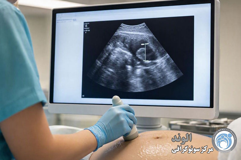 s/سونوگرافی جامع سه ماهه دوم بارداری