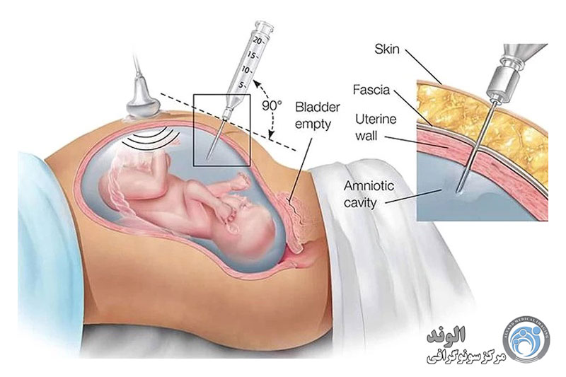 s/بهترین کلینیک آزمایش آمنیوسنتز