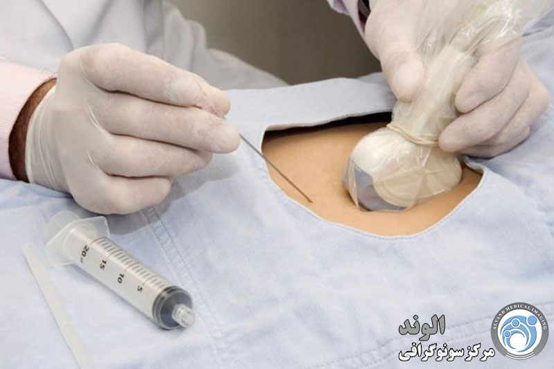 d/بهترین کلینیک آزمایش آمنیوسنتز